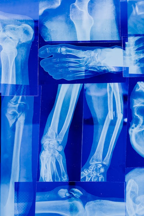 The Importance of Establishing a Permanent Injury in Florida Accident Cases
